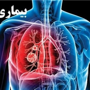 23مهر ماه "روز ملی مبارزه با سل "